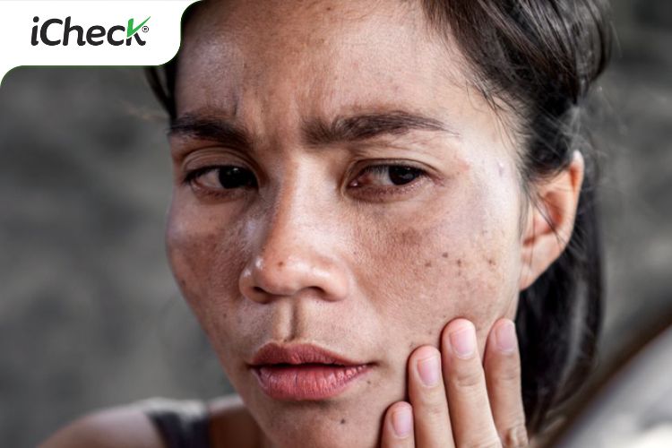 Cách kiểm tra tem chống hàng giả của Obagi 2 tem chong hang gia cua obagi 3